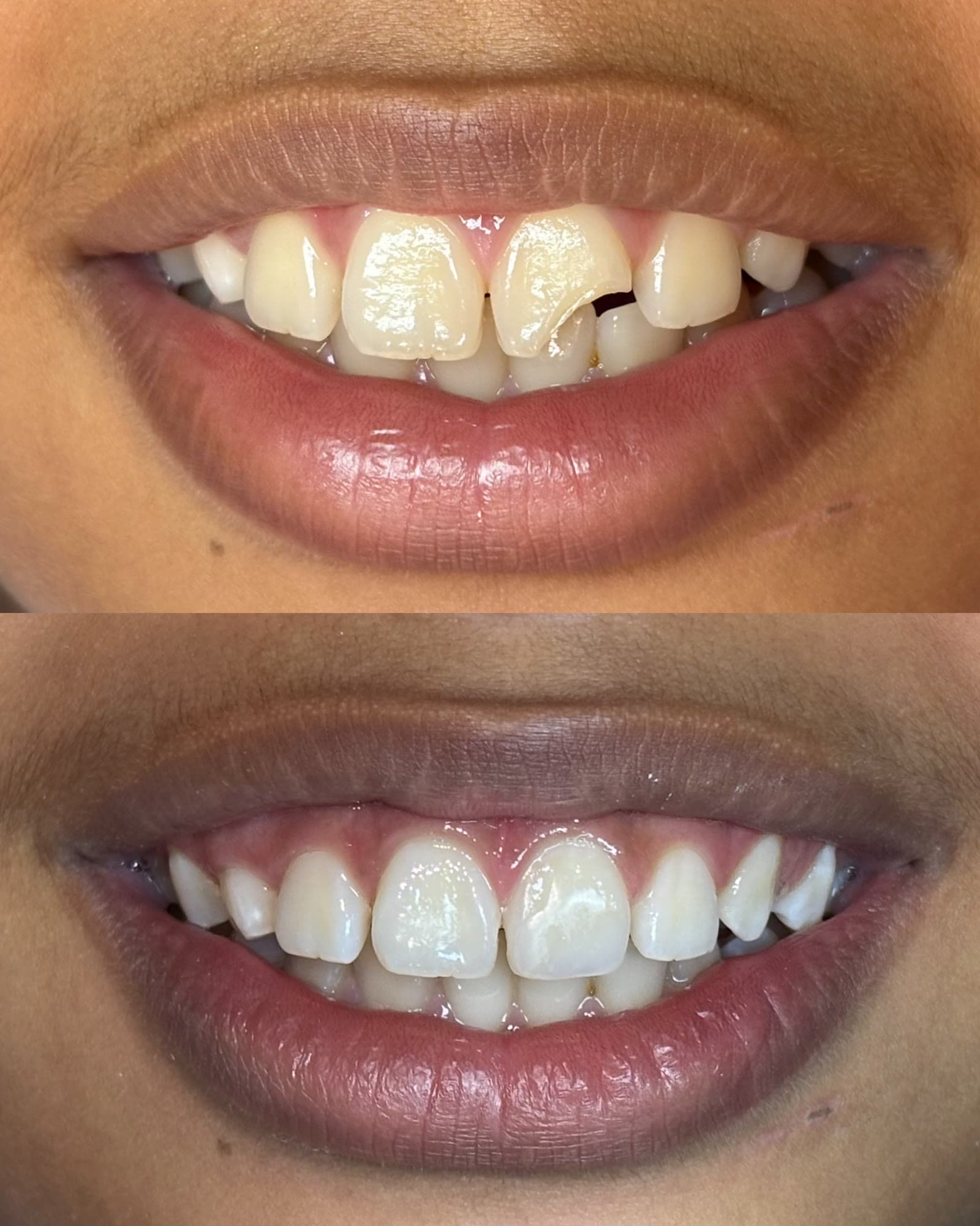 Antes e depois de restauração anterior